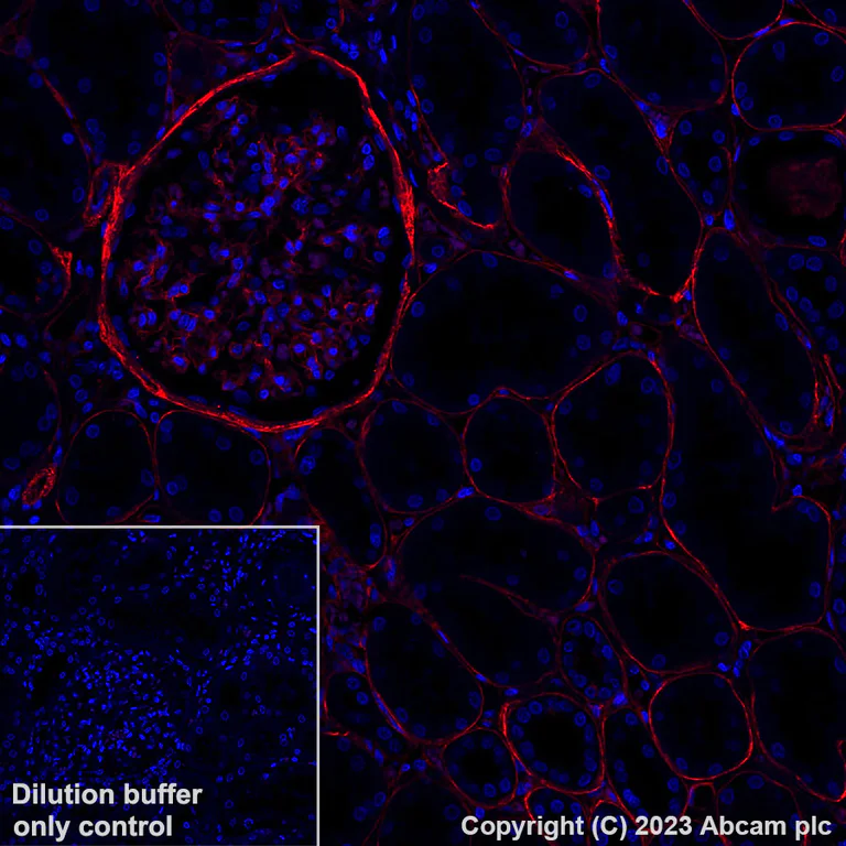 Alexa Fluor® 647 Anti-Collagen IV antibody [EPR22911-127
