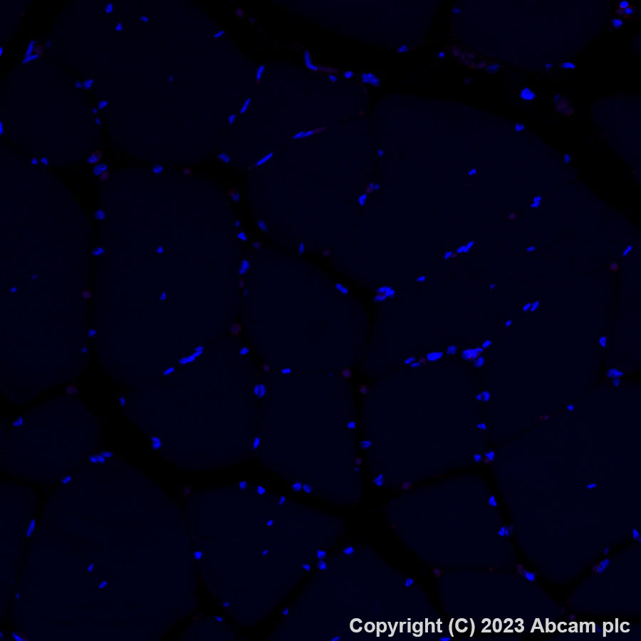 Alexa Fluor® 647 Anti-Collagen IV antibody [EPR22911-127