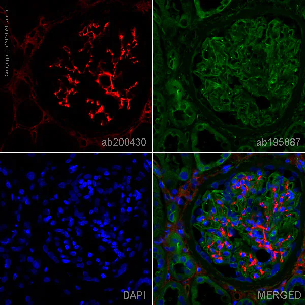 Immunohistochemistry (Formalin/PFA-fixed paraffin-embedded sections) - Alexa Fluor® 647 Anti-Collagen VI antibody [EPR17072] (AB200430)