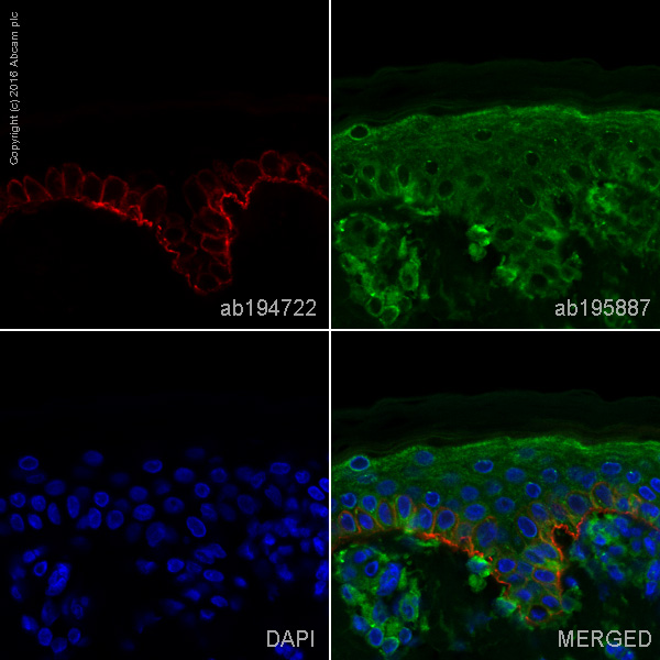 Immunohistochemistry (Formalin/PFA-fixed paraffin-embedded sections) - Alexa Fluor® 647 Anti-Collagen XVII antibody [EPR14758] (AB194722)