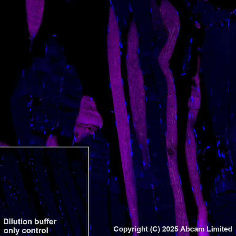 Immunohistochemistry (Formalin/PFA-fixed paraffin-embedded sections) - Alexa Fluor® 647 Anti-COMP/Cartilage oligomeric matrix protein antibody [EPR25364-6] (AB325111)
