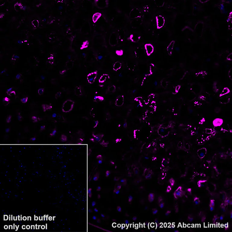 Immunohistochemistry (Formalin/PFA-fixed paraffin-embedded sections) - Alexa Fluor® 647 Anti-COMP/Cartilage oligomeric matrix protein antibody [EPR25364-6] (AB325111)