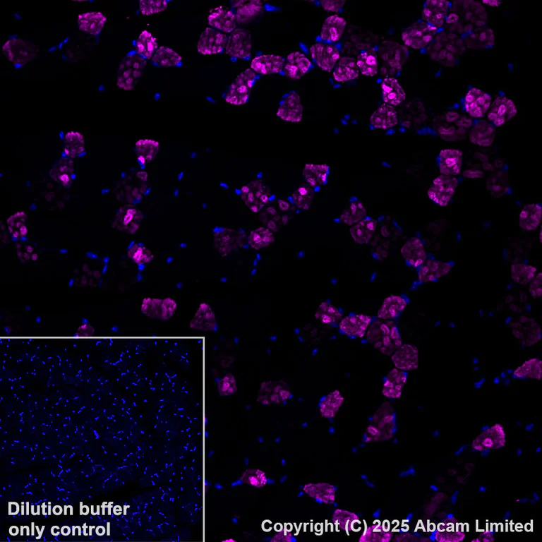 Immunohistochemistry (Formalin/PFA-fixed paraffin-embedded sections) - Alexa Fluor® 647 Anti-COMP/Cartilage oligomeric matrix protein antibody [EPR25364-6] (AB325111)
