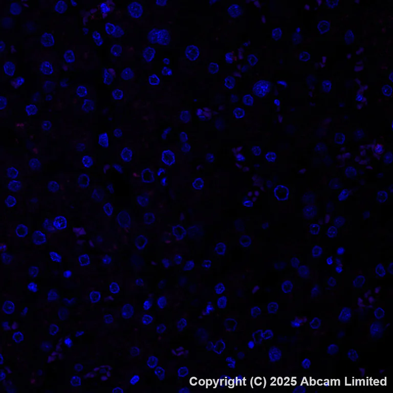 Immunohistochemistry (Formalin/PFA-fixed paraffin-embedded sections) - Alexa Fluor® 647 Anti-COMP/Cartilage oligomeric matrix protein antibody [EPR25364-6] (AB325111)