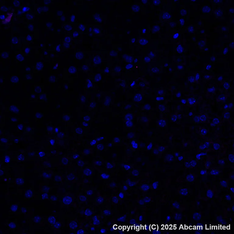 Immunohistochemistry (Formalin/PFA-fixed paraffin-embedded sections) - Alexa Fluor® 647 Anti-COMP/Cartilage oligomeric matrix protein antibody [EPR25364-6] (AB325111)