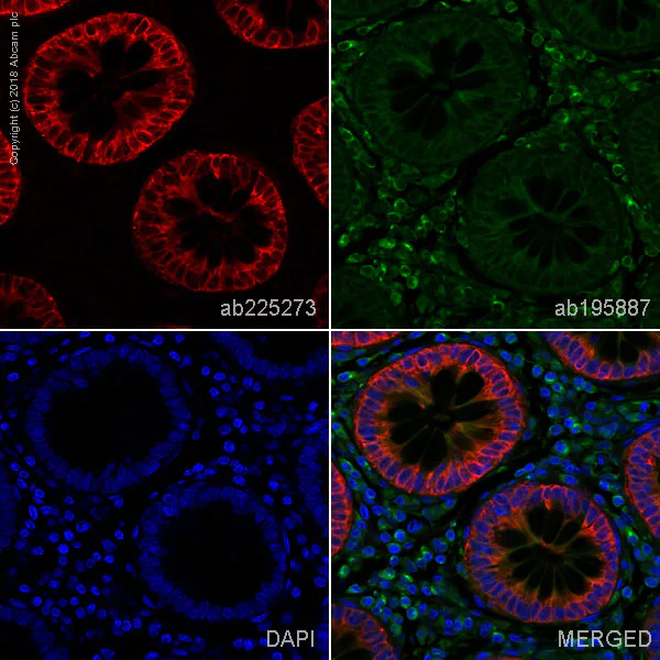 Immunohistochemistry (Formalin/PFA-fixed paraffin-embedded sections) - Alexa Fluor® 647 Anti-COX2 / Cyclooxygenase 2 antibody [EPR12012] (AB225273)