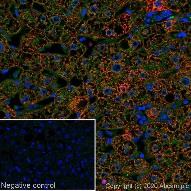 Immunohistochemistry (Formalin/PFA-fixed paraffin-embedded sections) - Alexa Fluor® 647 Anti-CPS1 antibody [EPR7493-3] (AB252115)