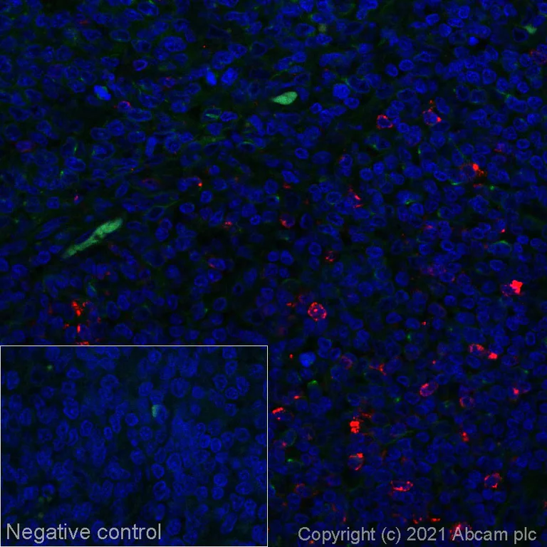 Immunohistochemistry (Formalin/PFA-fixed paraffin-embedded sections) - Alexa Fluor® 647 Anti-CTLA4 antibody [CAL49] (AB270127)