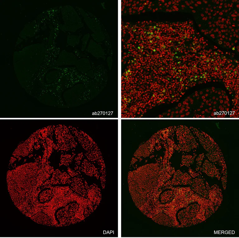 Multiplex immunohistochemistry - Alexa Fluor® 647 Anti-CTLA4 antibody [CAL49] (AB270127)