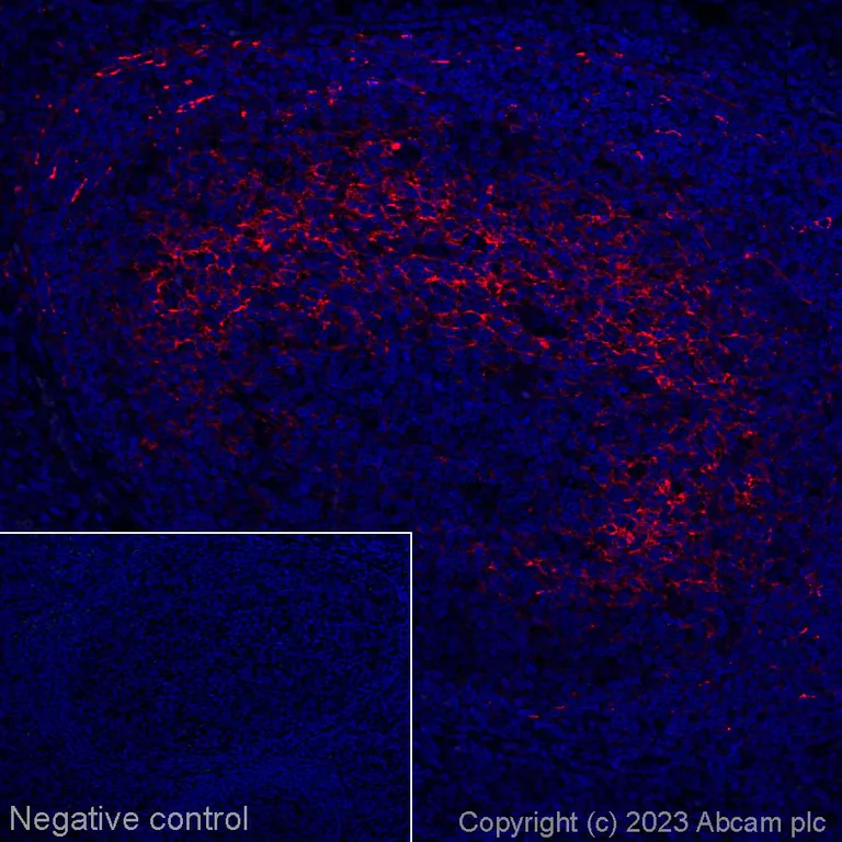 Immunohistochemistry (Formalin/PFA-fixed paraffin-embedded sections) - Alexa Fluor® 647 Anti-CXCL13 antibody [EPR23400-92] (AB314944)