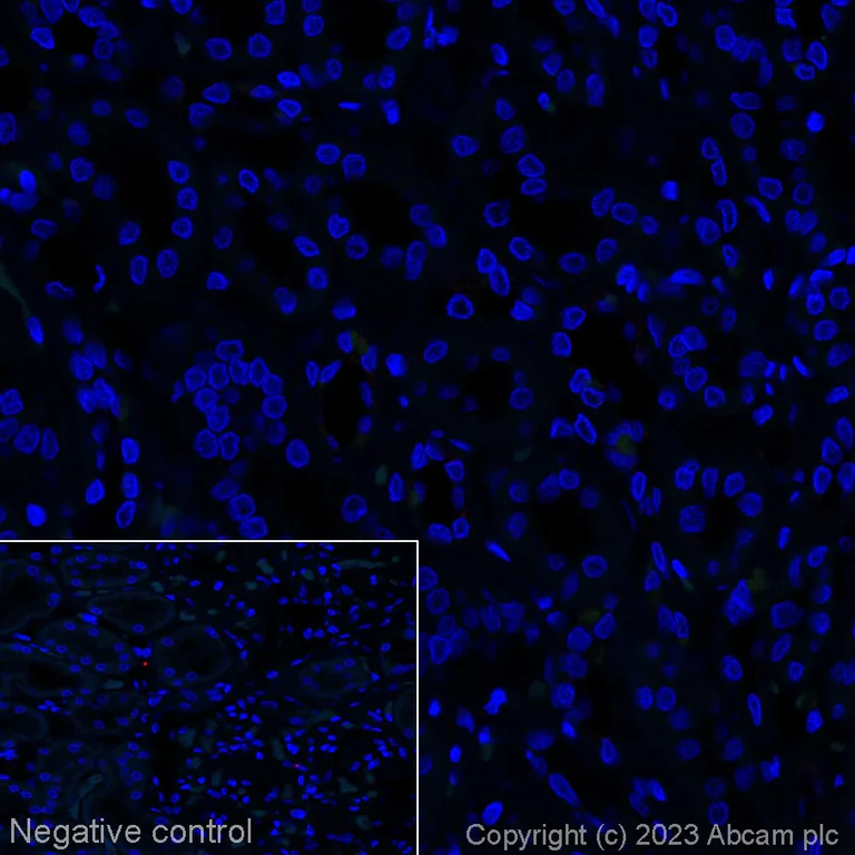 Immunohistochemistry (Formalin/PFA-fixed paraffin-embedded sections) - Alexa Fluor® 647 Anti-CXCL13 antibody [EPR23400-92] (AB314944)