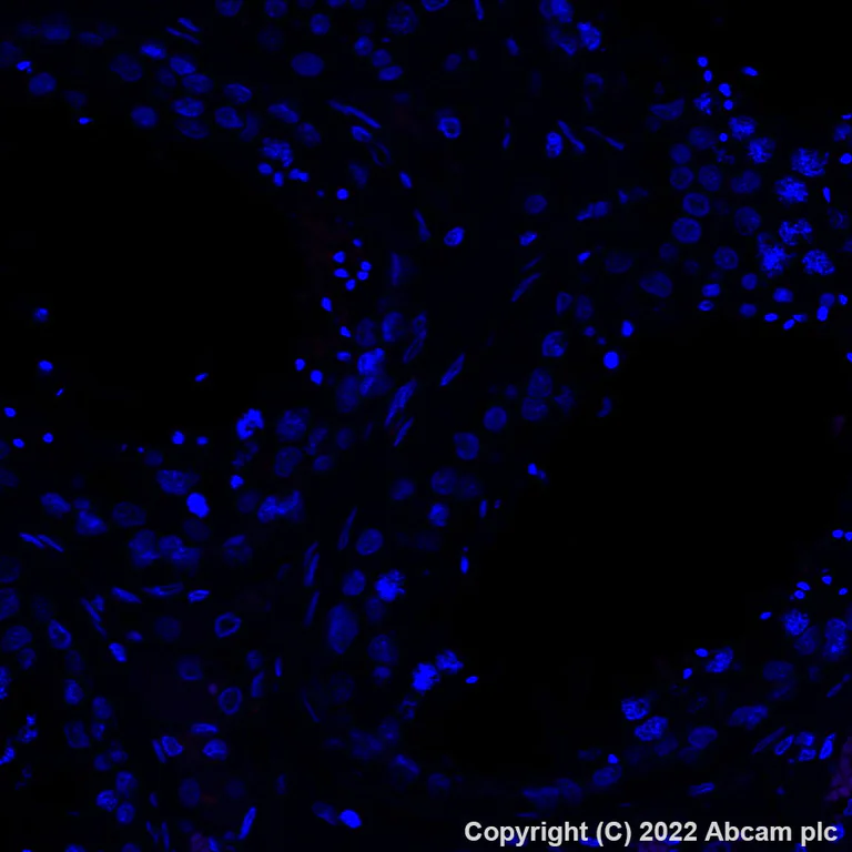 Immunohistochemistry (Formalin/PFA-fixed paraffin-embedded sections) - Alexa Fluor® 647 Anti-CXCL9 antibody [EPR26512-118] (AB308431)
