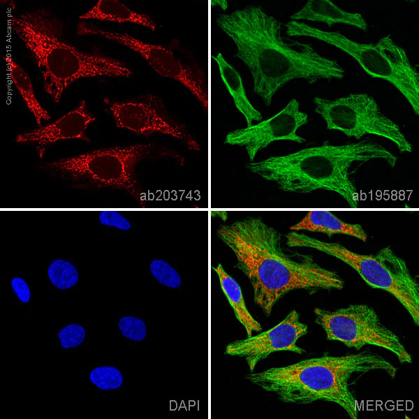Immunocytochemistry/ Immunofluorescence - Alexa Fluor® 647 Anti-Cytochrome P450 17A1/CYP17A1 antibody [EPR6293] (AB203743)