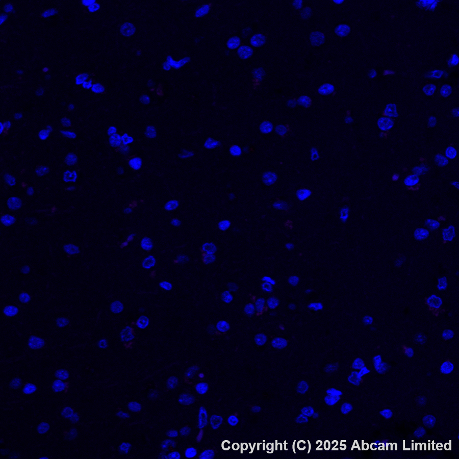 Immunohistochemistry (Formalin/PFA-fixed paraffin-embedded sections) - Alexa Fluor® 647 Anti-Cytochrome P450 3A4/CYP3A4 antibody [EPR6202] (AB323439), expandable thumbnail