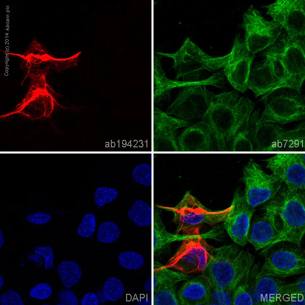 Immunocytochemistry/ Immunofluorescence - Alexa Fluor® 647 Anti-Cytokeratin 10 antibody [EP1607IHCY] (AB194231)
