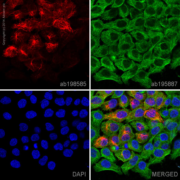 Immunocytochemistry/ Immunofluorescence - Alexa Fluor® 647 Anti-Cytokeratin 13 antibody [EPR3671] (AB198585), expandable thumbnail