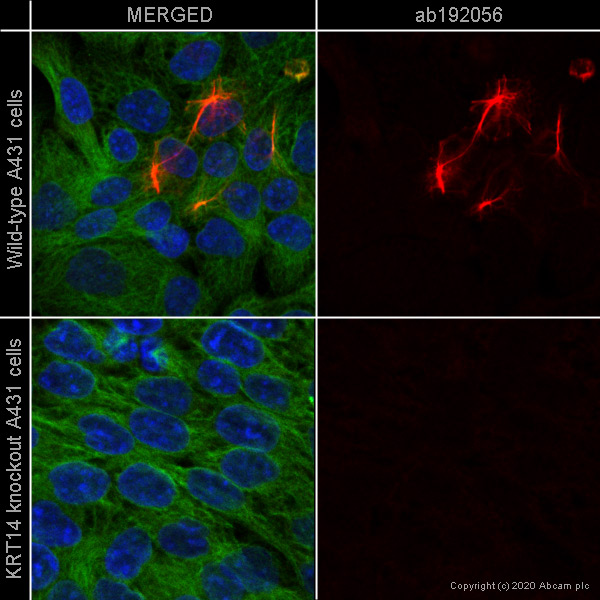 Immunocytochemistry/ Immunofluorescence - Alexa Fluor® 647 Anti-Cytokeratin 14 antibody [EP1612Y] (AB192056), expandable thumbnail