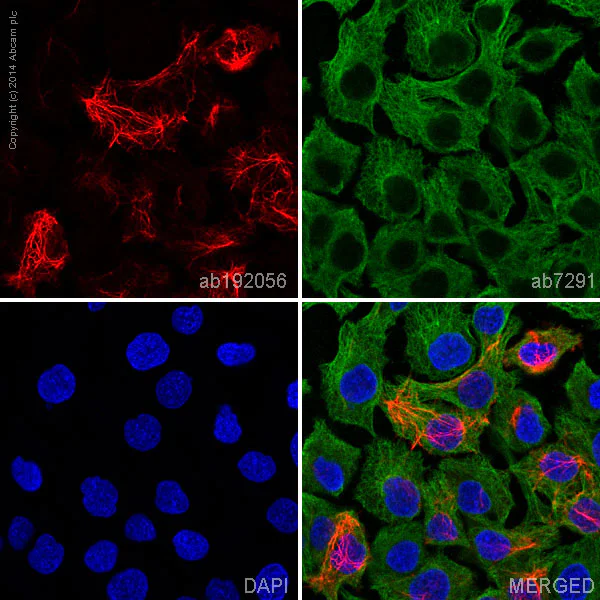 Immunocytochemistry/ Immunofluorescence - Alexa Fluor® 647 Anti-Cytokeratin 14 antibody [EP1612Y] (AB192056)