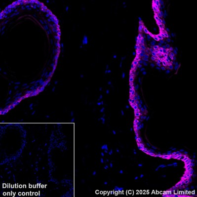 Immunohistochemistry (Formalin/PFA-fixed paraffin-embedded sections) - Alexa Fluor® 647 Anti-Cytokeratin 14 antibody [EP1612Y] (AB192056)