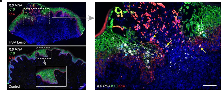 Immunohistochemistry - Alexa Fluor® 647 Anti-Cytokeratin 14 antibody [EP1612Y] (AB192056)