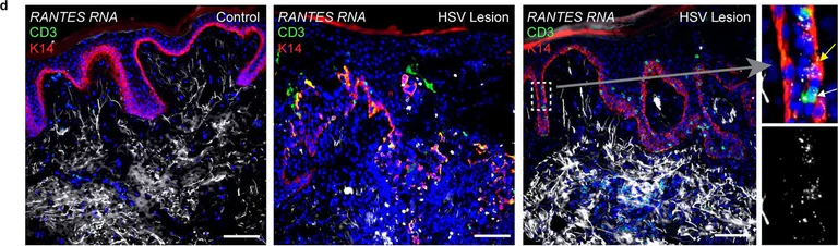 Immunohistochemistry - Alexa Fluor® 647 Anti-Cytokeratin 14 antibody [EP1612Y] (AB192056)