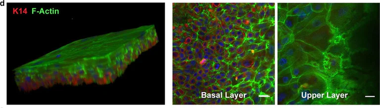 Immunohistochemistry - Alexa Fluor® 647 Anti-Cytokeratin 14 antibody [EP1612Y] (AB192056)