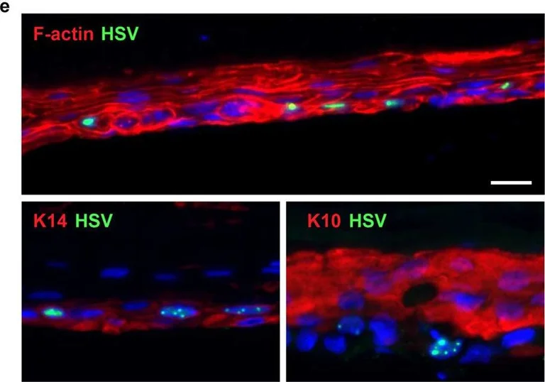 Immunohistochemistry - Alexa Fluor® 647 Anti-Cytokeratin 14 antibody [EP1612Y] (AB192056)