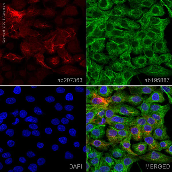 Immunocytochemistry/ Immunofluorescence - Alexa Fluor® 647 Anti-Cytokeratin 14 antibody [EPR1612] (AB207363)