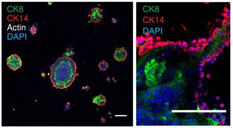 Immunocytochemistry - Alexa Fluor® 647 Anti-Cytokeratin 14 antibody [EPR17350] (AB206100)