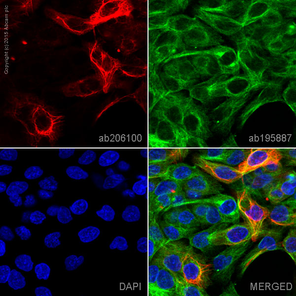 Immunocytochemistry - Alexa Fluor® 647 Anti-Cytokeratin 14 antibody [EPR17350] (AB206100)