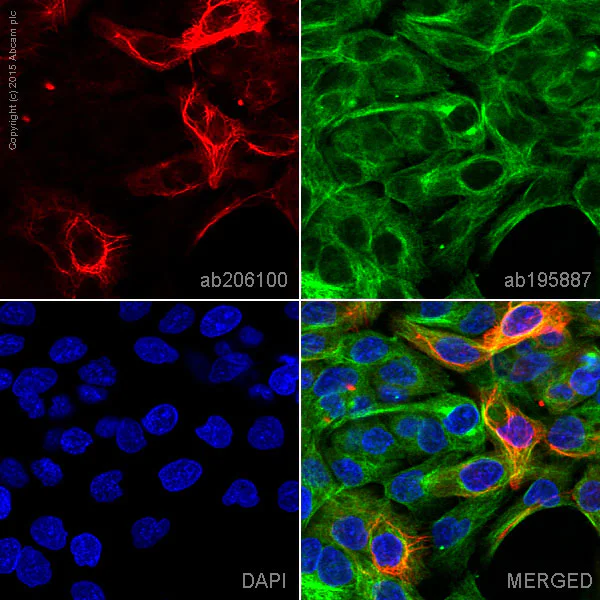 Immunocytochemistry - Alexa Fluor® 647 Anti-Cytokeratin 14 antibody [EPR17350] (AB206100)