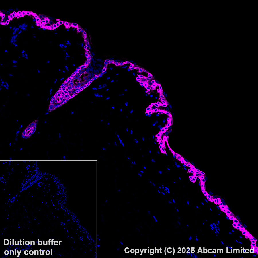 Immunohistochemistry (Formalin/PFA-fixed paraffin-embedded sections) - Alexa Fluor® 647 Anti-Cytokeratin 14 antibody [EPR17350] (AB206100)
