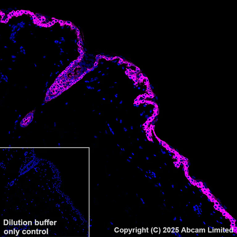 Anti-Cytokeratin 14 Alexa Fluor® 647 antibody [EPR17350] (ab206100