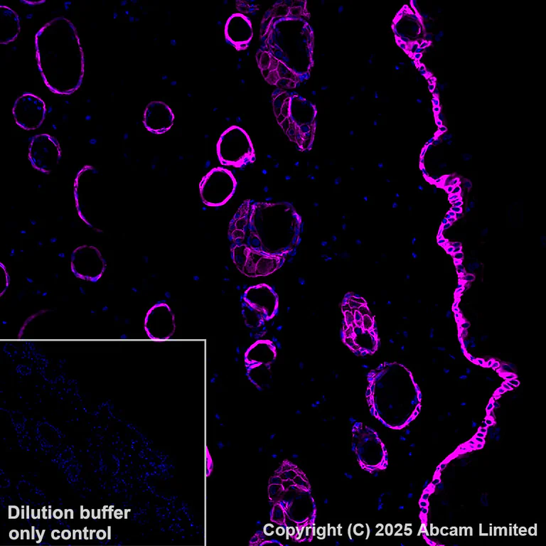 Immunohistochemistry (Formalin/PFA-fixed paraffin-embedded sections) - Alexa Fluor® 647 Anti-Cytokeratin 14 antibody [EPR17350] (AB206100)