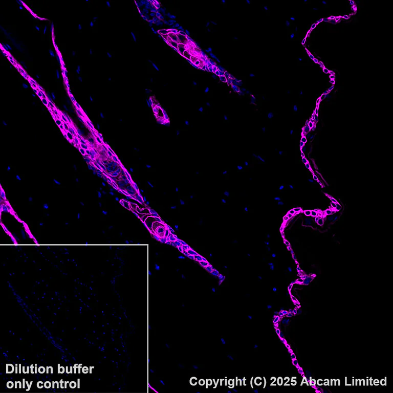 Immunohistochemistry (Formalin/PFA-fixed paraffin-embedded sections) - Alexa Fluor® 647 Anti-Cytokeratin 14 antibody [EPR17350] (AB206100)