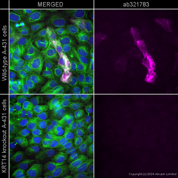 Immunocytochemistry/ Immunofluorescence - Alexa Fluor® 647 Anti-Cytokeratin 14 antibody [LL002] (AB321783), expandable thumbnail