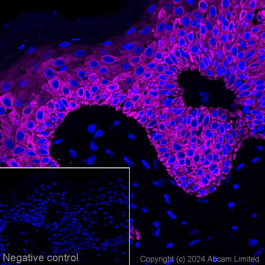 Immunohistochemistry (Formalin/PFA-fixed paraffin-embedded sections) - Alexa Fluor® 647 Anti-Cytokeratin 14 antibody [LL002] (AB321783), expandable thumbnail