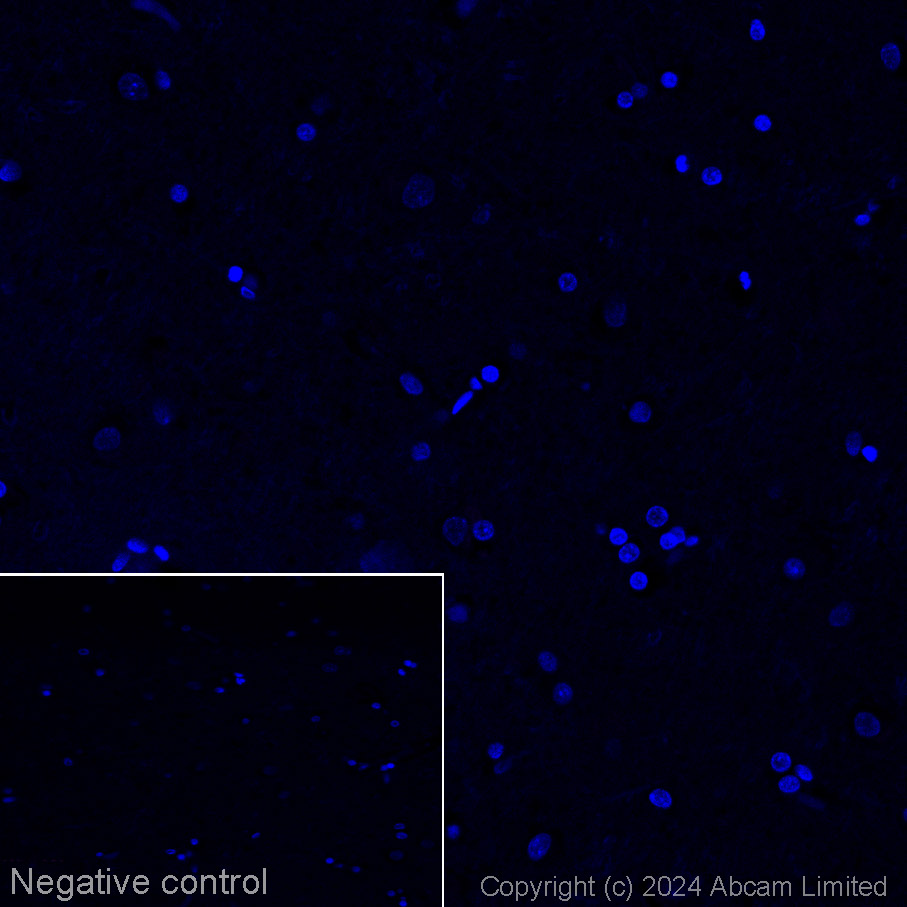 Immunohistochemistry (Formalin/PFA-fixed paraffin-embedded sections) - Alexa Fluor® 647 Anti-Cytokeratin 14 antibody [LL002] (AB321783), expandable thumbnail