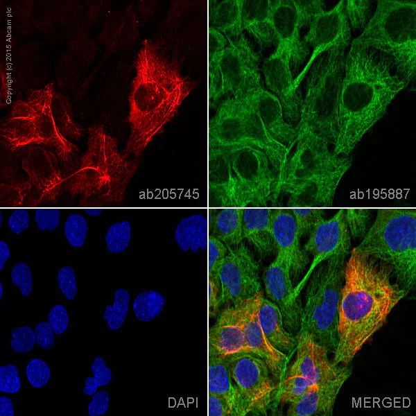 Immunocytochemistry/ Immunofluorescence - Alexa Fluor® 647 Anti-Cytokeratin 16/K16 antibody [EP1615Y] (AB205745)