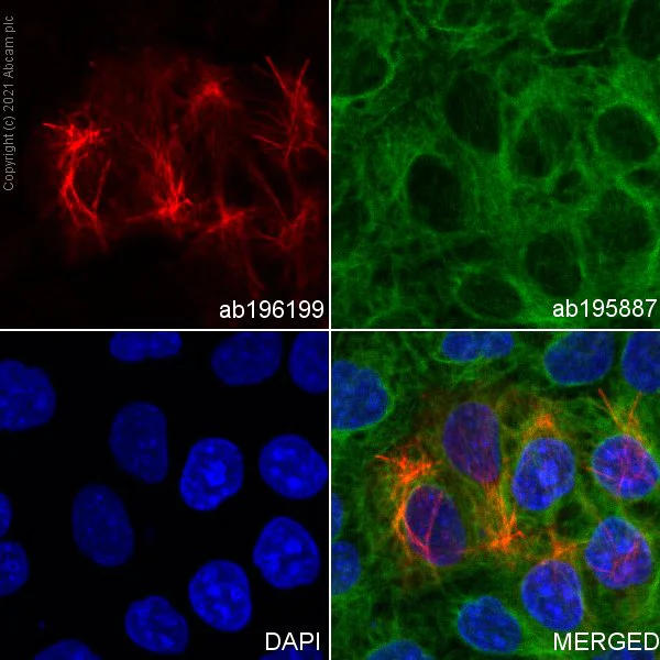 Immunocytochemistry/ Immunofluorescence - Alexa Fluor® 647 Anti-Cytokeratin 17 antibody [EP1623] - Cytoskeleton Marker (AB196199)