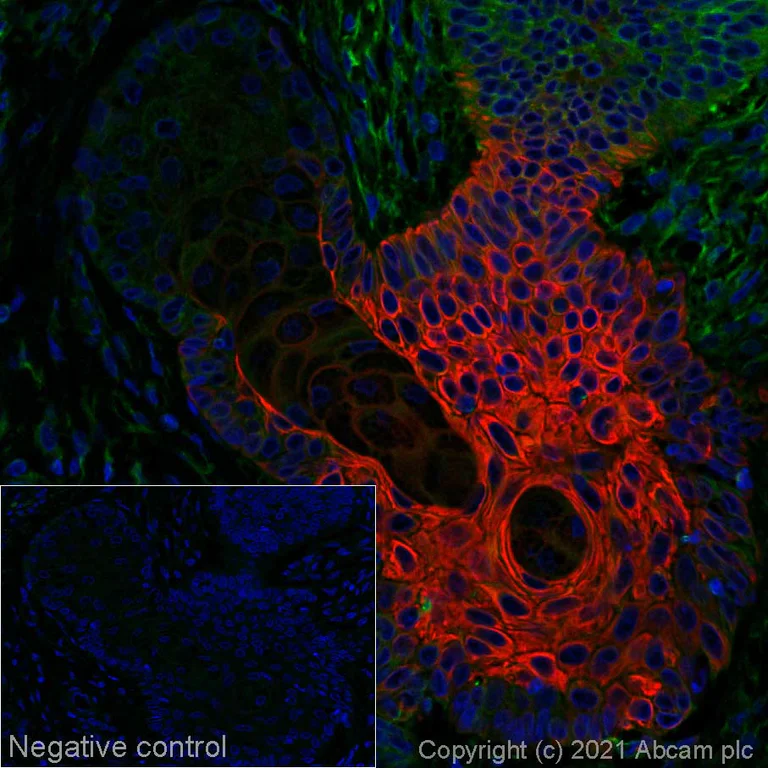 Immunohistochemistry (Formalin/PFA-fixed paraffin-embedded sections) - Alexa Fluor® 647 Anti-Cytokeratin 17 antibody [SP95] (AB270903)