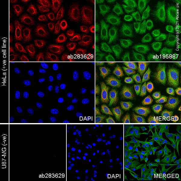 Immunocytochemistry/ Immunofluorescence - Alexa Fluor® 647 Anti-Cytokeratin 18 antibody [E431-1] (AB283629)