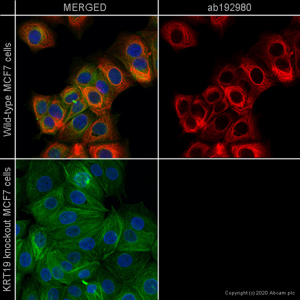 Alexa Fluor® 647 conjugated Anti-Cytokeratin 19 antibody [EP1580Y