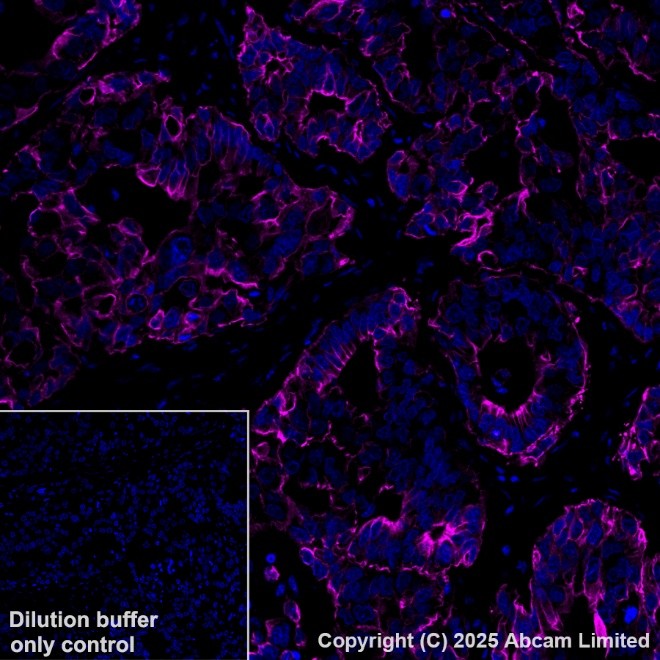 Alexa Fluor® 647 conjugated Anti-Cytokeratin 19 antibody [EP1580Y