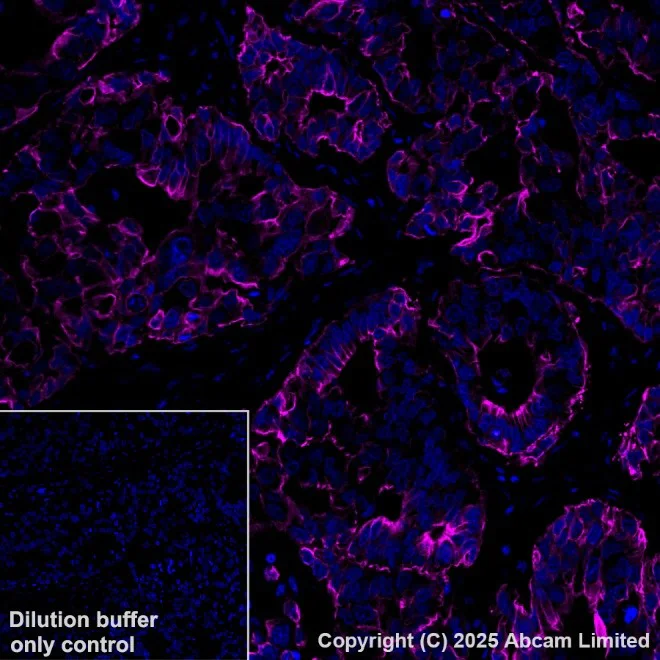 Immunohistochemistry (Formalin/PFA-fixed paraffin-embedded sections) - Alexa Fluor® 647 Anti-Cytokeratin 19 antibody [EP1580Y] (AB192980)