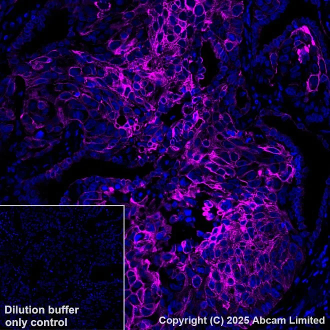cyanosis様 Alexa Fluor® 647 conjugated Anti-Cytokeratin 19 antibody [EP1580Y