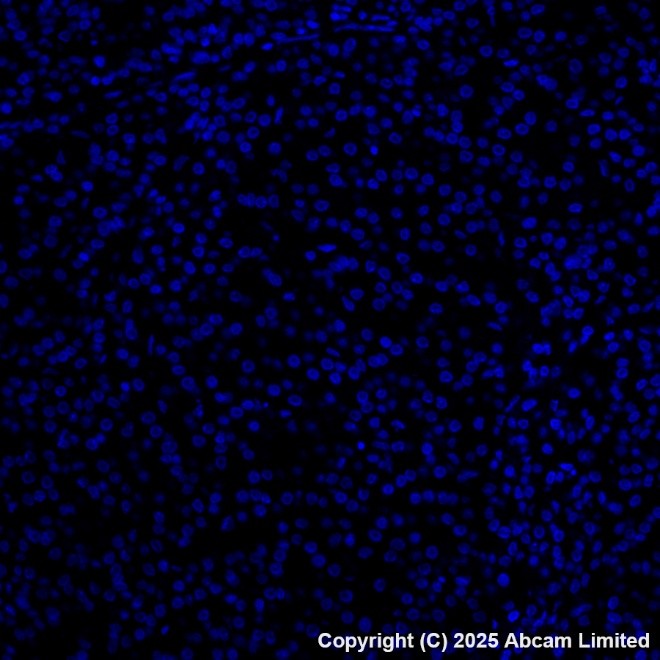 Alexa Fluor® 647 conjugated Anti-Cytokeratin 19 antibody [EP1580Y
