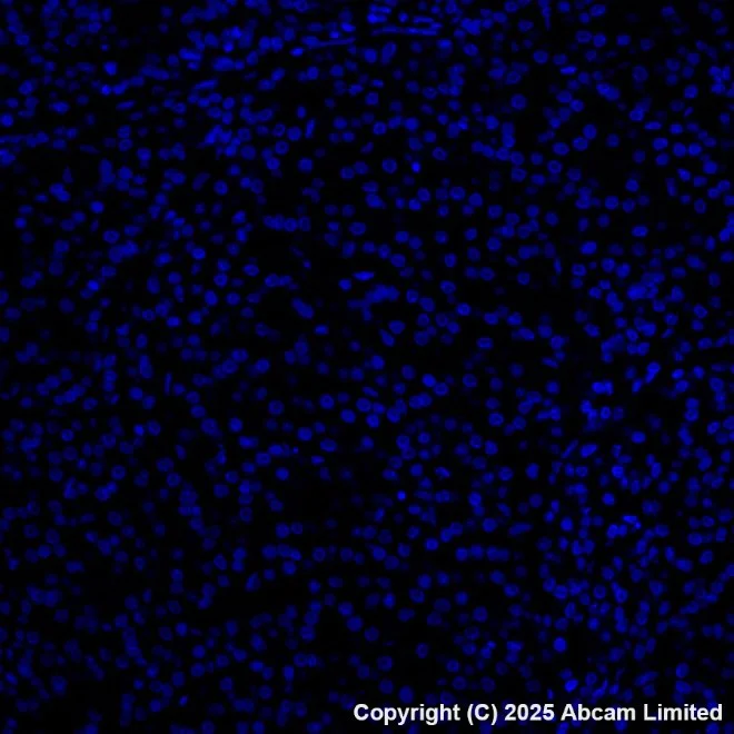 Alexa Fluor® 647 conjugated Anti-Cytokeratin 19 antibody [EP1580Y
