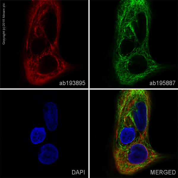 Immunocytochemistry/ Immunofluorescence - Alexa Fluor® 647 Anti-Cytokeratin 5 antibody [EP1601Y] (AB193895), expandable thumbnail