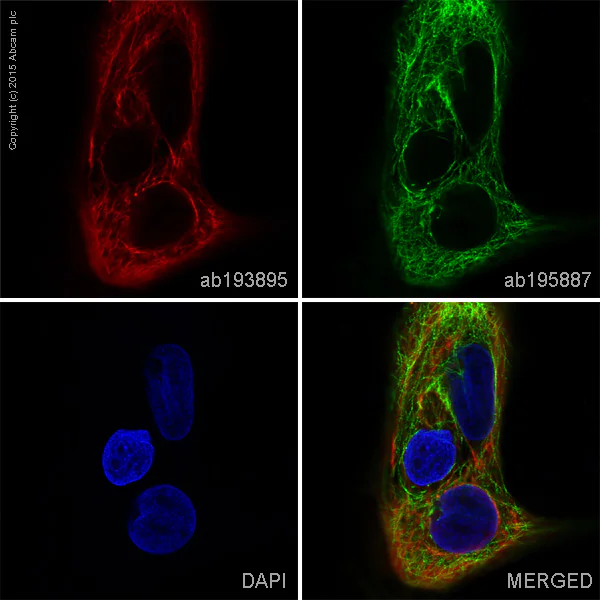 Immunocytochemistry/ Immunofluorescence - Alexa Fluor® 647 Anti-Cytokeratin 5 antibody [EP1601Y] (AB193895)